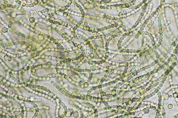 Cyanobacteria photo by Richard Droker